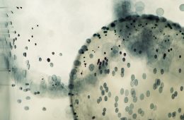 ¿Cuáles son las causas de las bacterias bucales y cómo pueden afectar a la salud bucal?