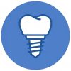 Implantes Dentales